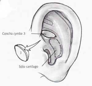 cartílago del oído
