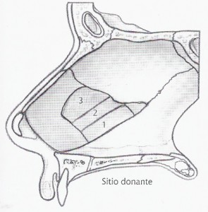cartilago septal