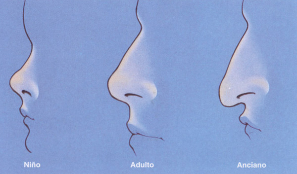Etapas de envejecimiento de la nariz